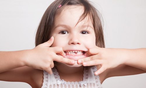 child grinning with a missing tooth